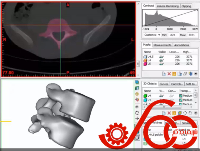 استفاده از نوار ابزار Boolean در نرم افزار Mimics